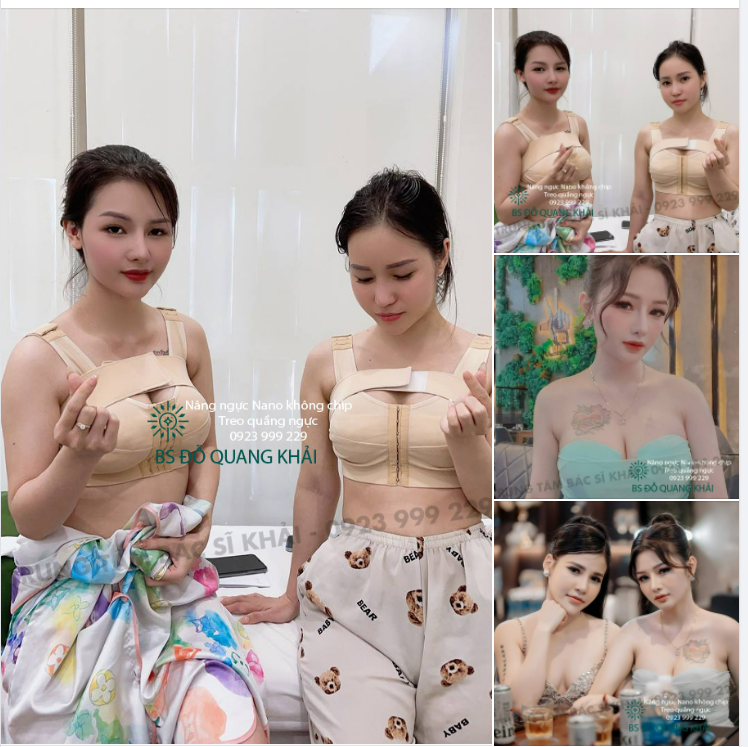 ĐI NÂNG NGỰC CÙNG BẠN THÂN, BẠN ĐÃ THỬ CHƯA