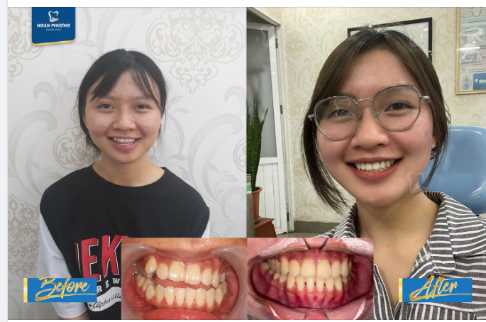 DỊCH CHUYỂN NHỎ, THAY ĐỔI LỚN