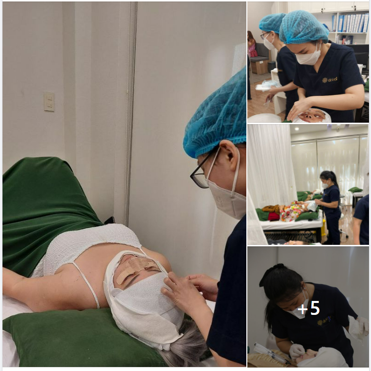 DỊCH VỤ ĐỈNH CỦA NGÀY HÔM NAY - CĂNG DA MẶT NỘI SOI