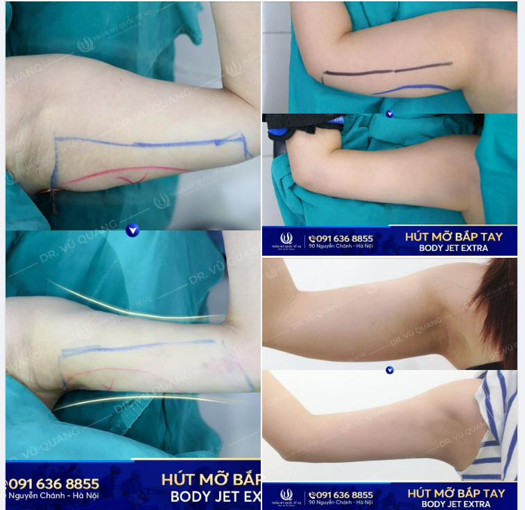 Dịch vụ hot nhất trong những ngày qua tại VQ