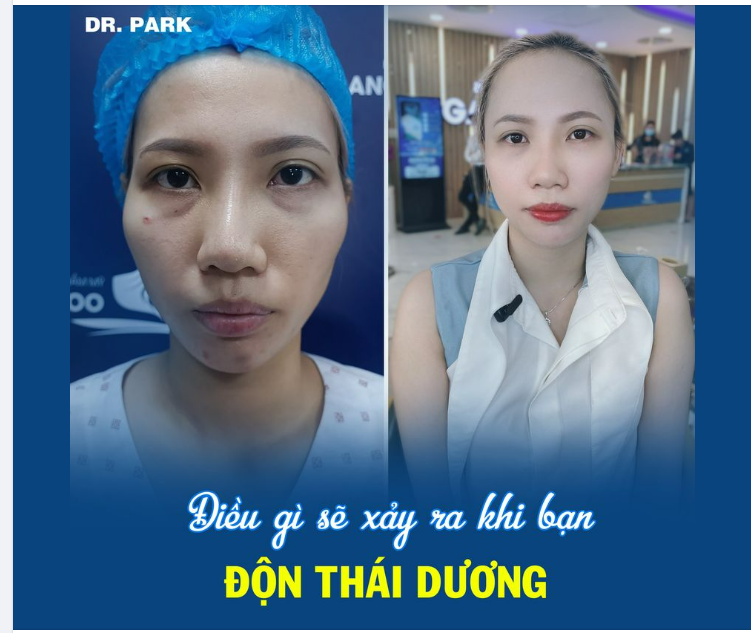 ĐIỀU GÌ SẼ XẢY RA KHI BẠN ĐỘN THÁI DƯƠNG