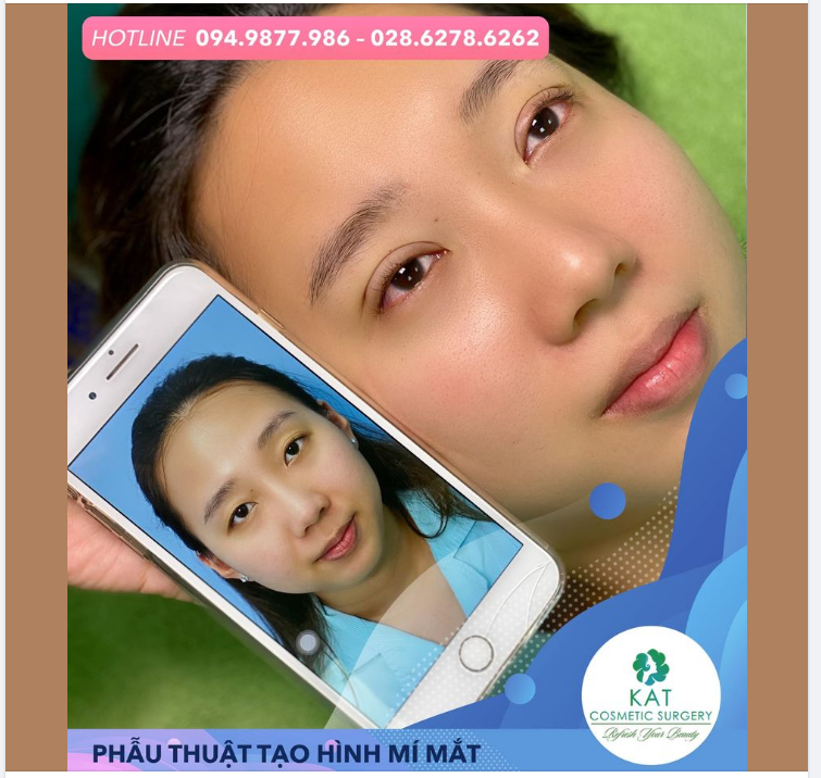 “ Đôi mắt long lanh chỉ sau 15 phút ’ “