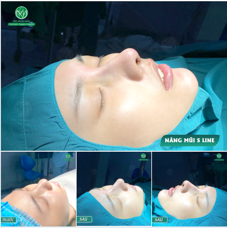 ĐỘNG LỰC ĐỂ ĐI NÂNG MŨI LÀ ĐÂY !!