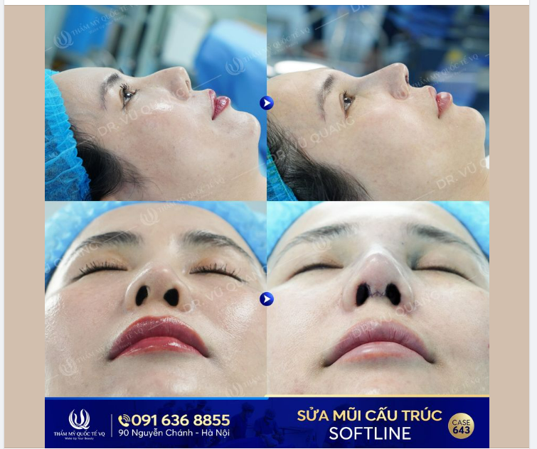 Dr Vũ Quang - Tái sinh mũi hỏng - Vực dậy niềm tin