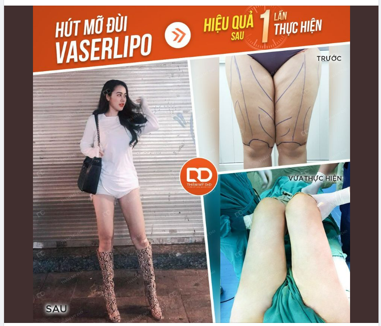 ĐÙI TO HÓA THON GỌN SAU BAO NHIÊU PHÚT THỰC HIỆN