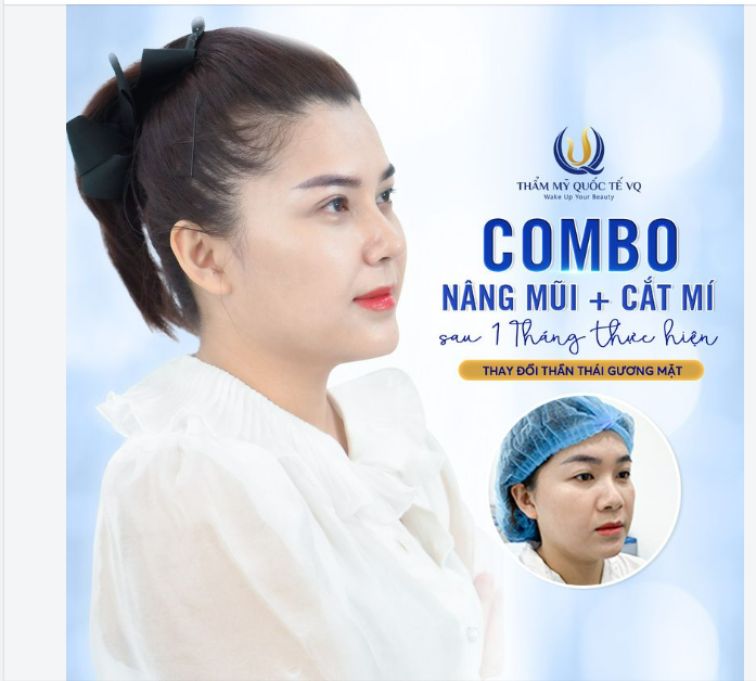 Đừng để Mũi Mí kém xinh cản trở sự tự tin của bạn