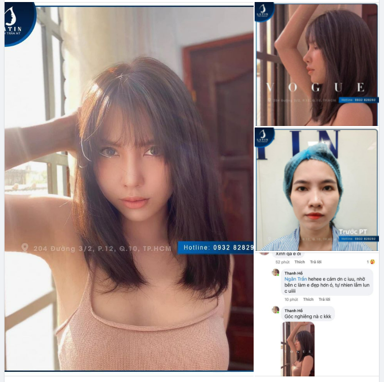 FEEDBACK Khách hàng gửi hình sau một tháng làm combo tại Latin mà nhận không ra, trông khách quá xinh đẹp với diện mạo mới này.