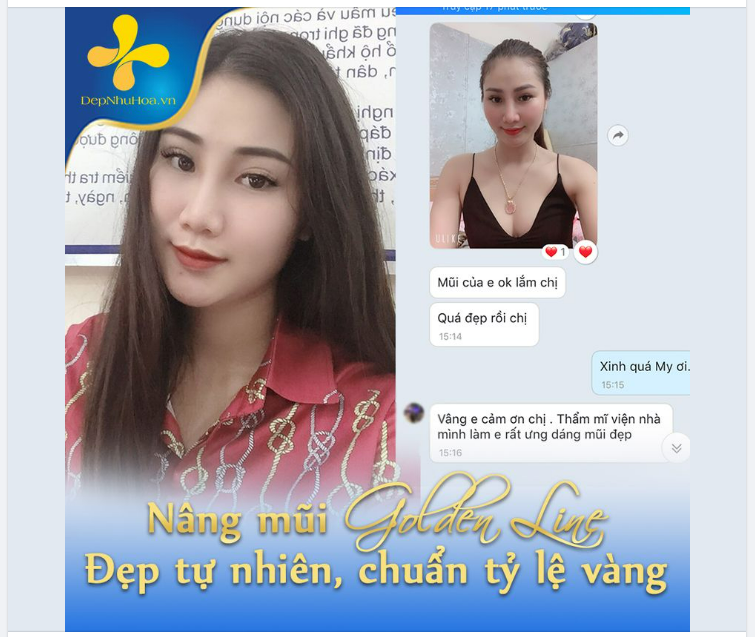Feedback khách hàng sau khi nâng mũi