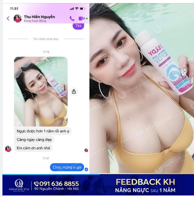 Feedback Nâng vòng 1 - Hình ảnh thực tế sau 1 năm thực hiện.