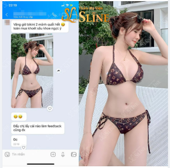 FEEDBACK ngực đẹp cùng Sline