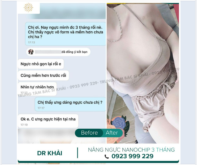 FEEDBACK SAU 3 THÁNG NÂNG VÒNG 1