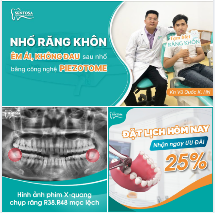 GIẢI QUYẾT NỖI ĐAU RĂNG KHÔN NHẸ NHÀNG - CHÍNH XÁC - KHÔNG ĐAU