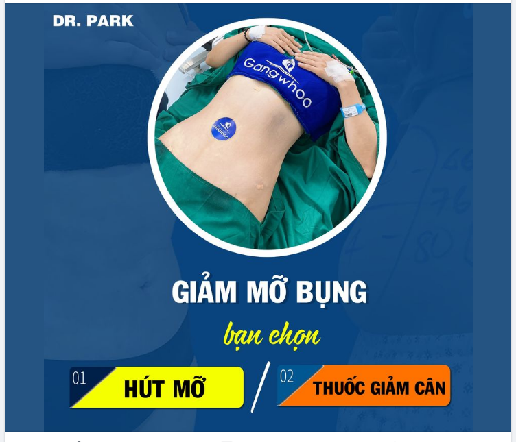GIẢM MỠ BỤNG - BẠN CHỌN HÚT MỠ HAY UỐNG THUỐC GIẢM CÂN