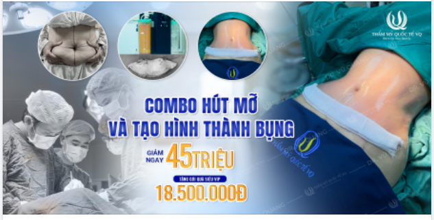 Giảm ngay 45 triệu khi làm Combo Hút mỡ bụng Công nghệ Body Jet Extra + Tạo hình thành bụng.