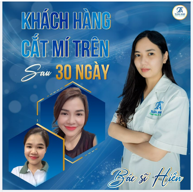 - ''Giờ em thoải mái makeup mà không phải lo mắt mí bé, một mí nữa rồi. Cả gương mặt có điểm nhấn là đôi mắt, giờ 2 mí xinh rồi em trang điểm cũng tự tin hơn. Ai cũng khen mí đẹp mà nhìn tự nhiên lắm''