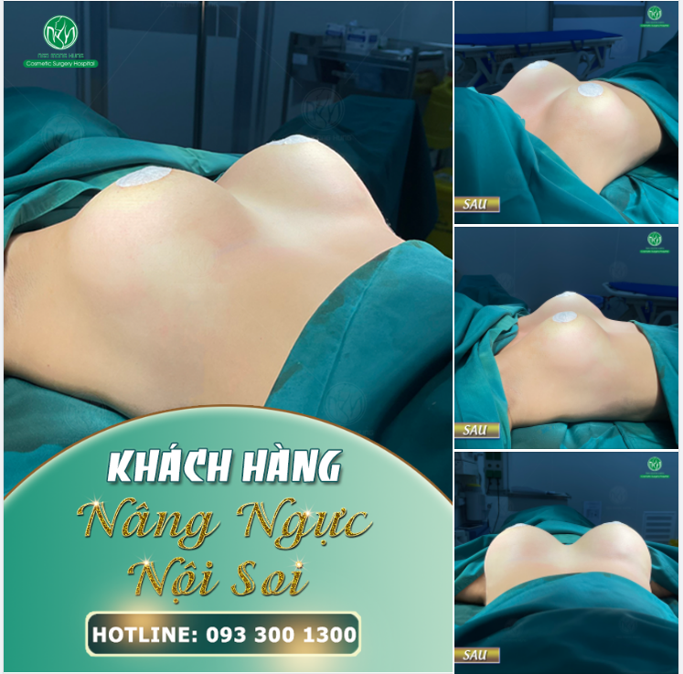GÓC ĐỘ NÀO CŨNG ĐẸP - CHỈ CÓ THỂ LÀ NÂNG NGỰC TẠI BVTM NGÔ MỘNG HÙNG !!