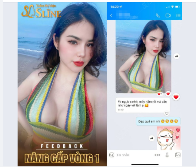 Góc feedback. NÂNG CẤP VÒNG 1 - BẢO HÀNH TRỌN ĐỜI