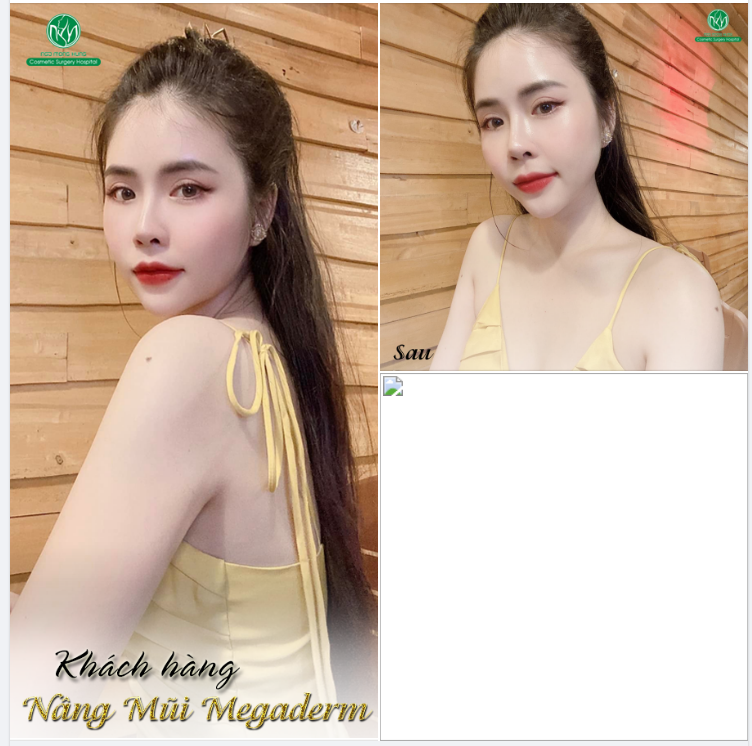 H ĐẸP KHÔNG KHÓ CHỈ CẦN BẠN CÓ QUYẾT TÂM