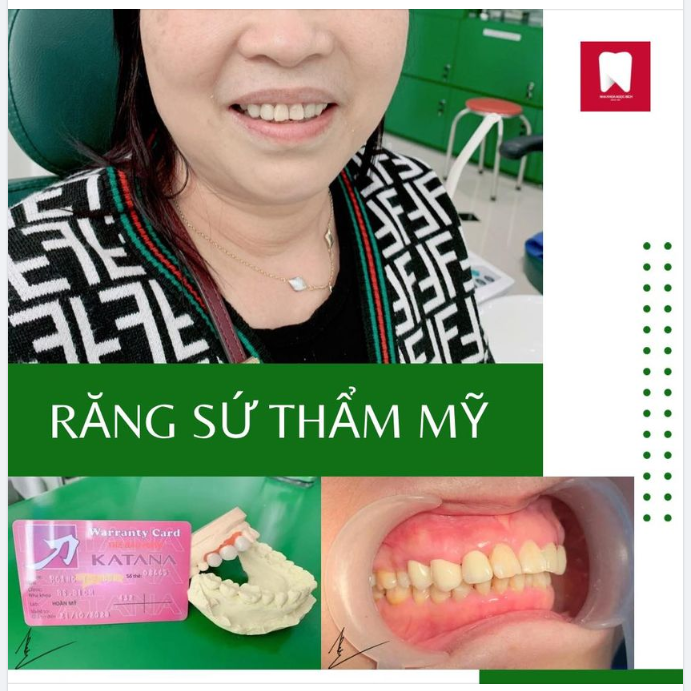 HÀM RĂNG ĐỀU ĐẸP SẼ GIÚP BẠN TRẺ RA VÀI TUỔI 