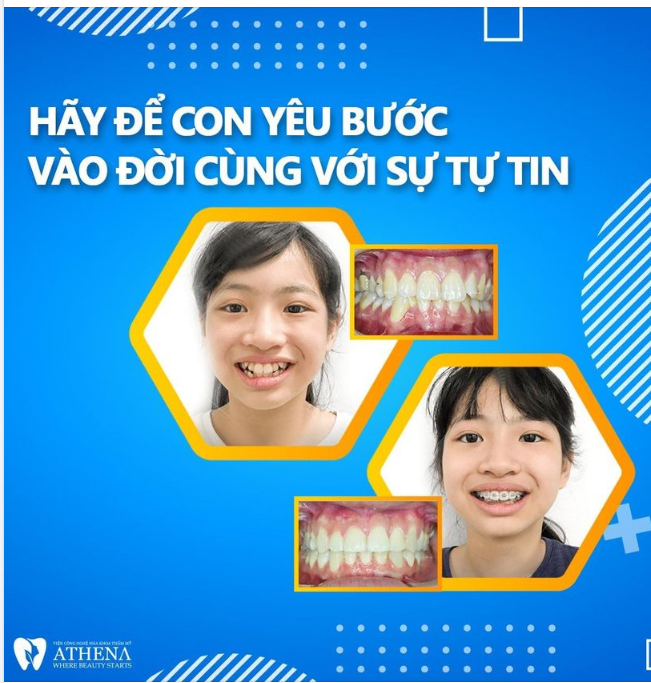 HÃY ĐỂ CON YÊU BƯỚC VÀO ĐỜI CÙNG VỚI SỰ TỰ TIN 