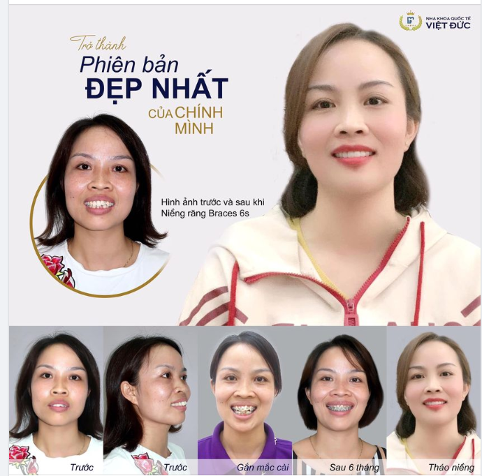 HÃY TRỞ THÀNH PHIÊN BẢN ĐẸP NHẤT CỦA CHÍNH MÌNH