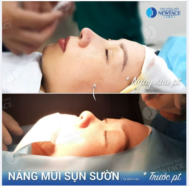 Hãy yêu đời dù nắng to hay mưa bão. Đời của mình, mình cứ vẽ cho xinh…!