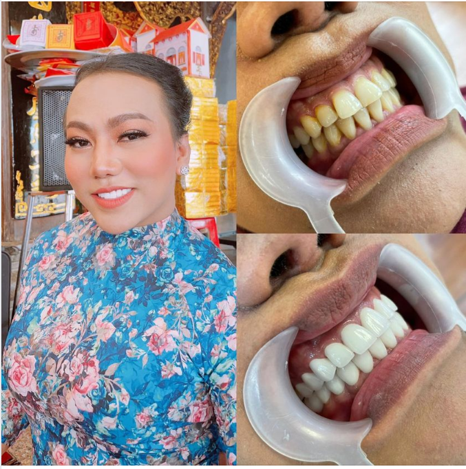Hoa đầu mùa bao giờ cũng đẹp