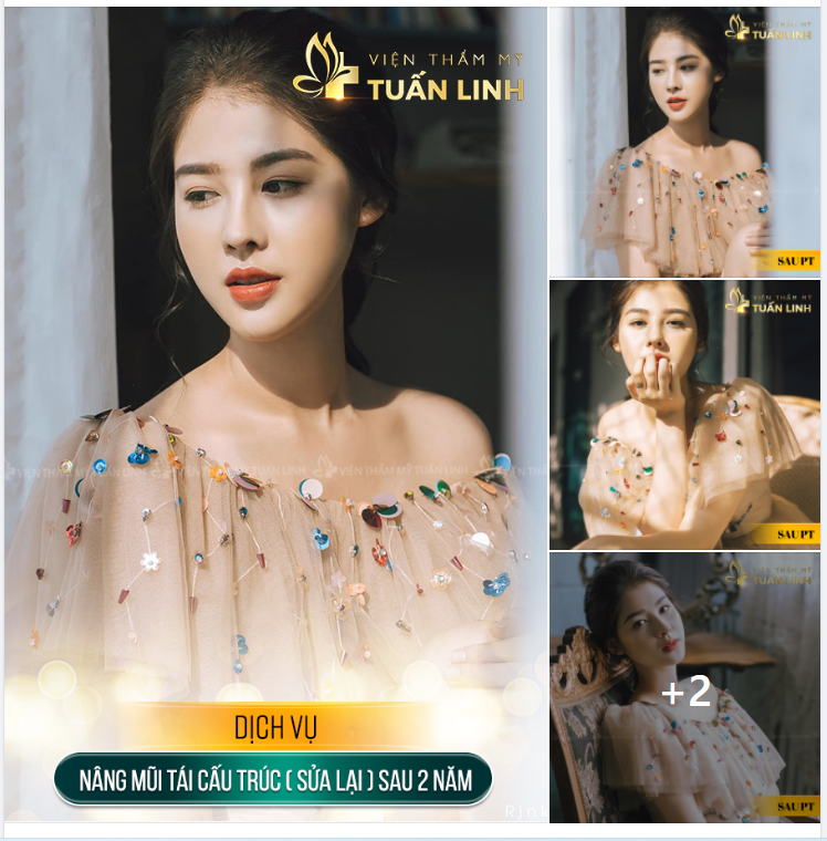 Hóa nàng thơ sau nâng mũi sửa lại!!!