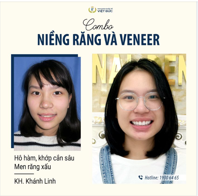 HOÀN THIỆN ƯỚC MƠ NỤ CƯỜI ĐẸP