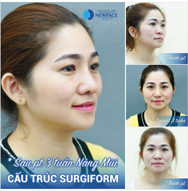 Hôm nay em bận yêu mình. Hẹn anh hôm khác chúng mình yêu nhau…!