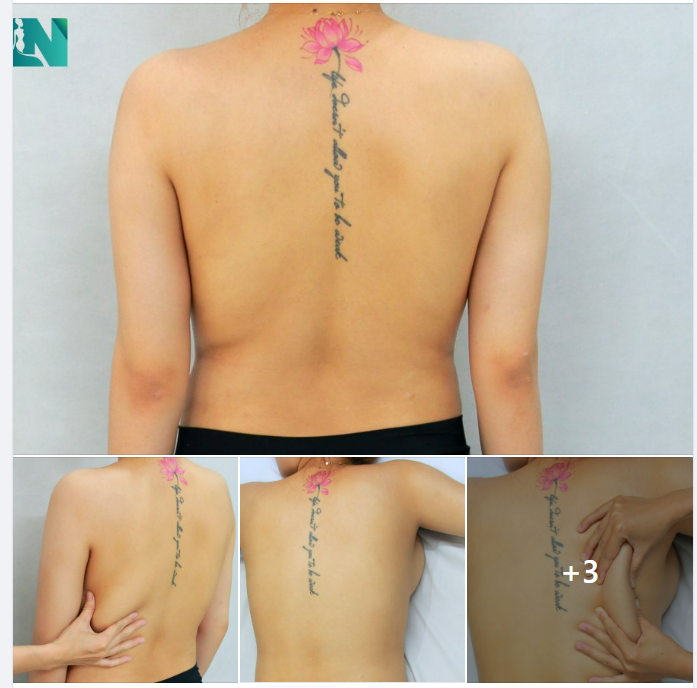 HÚT MỠ TẠO DÁNG THẨM MỸ VÙNG TAY LƯNG NÁCH, GIẢI PHÁP CÂN ĐỐI DÁNG VÓC CHO CHỊ KH 9X ĐẾN TỪ ĐÀ NẴNG, TRỰC TIẾP 16H00 – 16H30 HÔM NAY