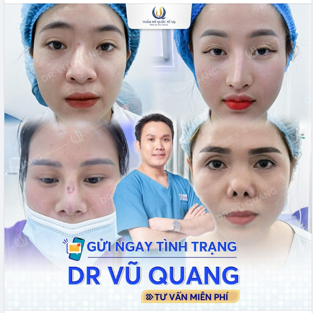 Inbox ngay nếu bạn đang gặp phải 1 trong Các trường hợp biến chứng sau nâng mũi dưới đây