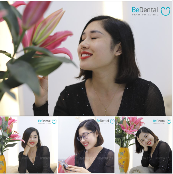 KH Hồng Ngọc lựa chọn Bedental khắc phục nhược điểm răng ố vàng, cười hở lợi, hình thể không cân đối