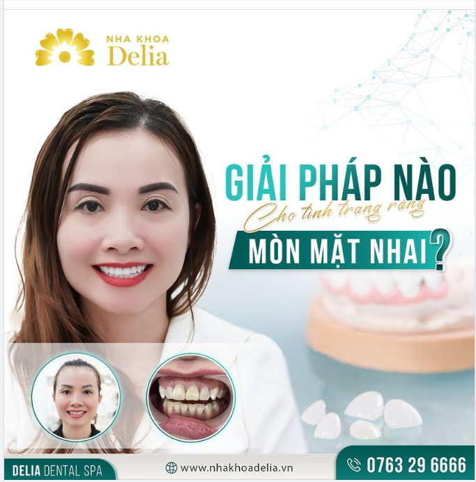 Khắc phục răng mòn mặt nhai - Càng sớm càng tốt!