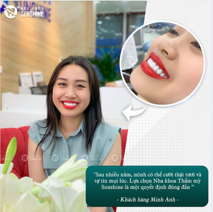 Khách hàng bất ngờ với công nghệ làm răng không hề ê buốt, đau đớn, đặc biệt không mài nhỏ và điều trị tuỷ.