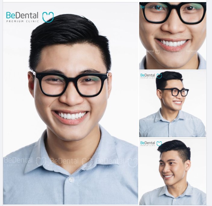 Khách hàng Hồng Thái tìm lại chân ái hàm răng trắng khỏe