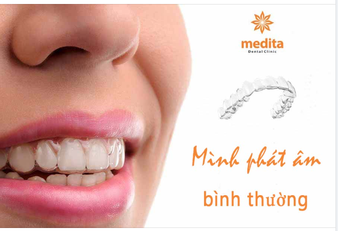 KHAY NIỀNG CÓ ẢNH HƯỞNG ĐẾN PHÁT ÂM KHÔNG?