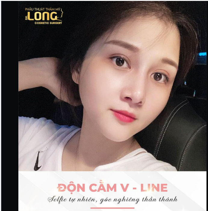 KHÔNG CẦN DÙNG APP “BÓP MẶT” VÌ ĐÃ CÓ CẰM XINH, CHINH PHỤC MỌI GÓC CHỤP