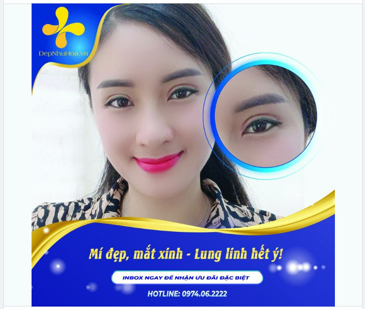 KHỦNG HOẢNG NHAN SẮC TUỔI 30, PHỤ NỮ CÓ SỢ