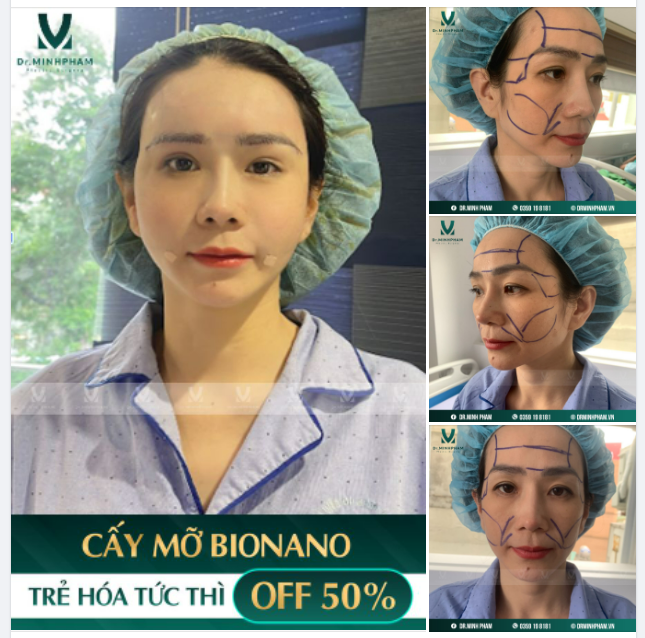 Khuôn mặt đầy đặn, rạng ngời không tì vết là mong muốn của tất cả mọi người.