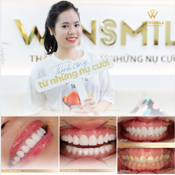 KIÊN ĐỊNH VỚI ƯỚC MƠ, NỤ CƯỜI XỨNG ĐÁNG CHO MỌI SỰ MONG CHỜ