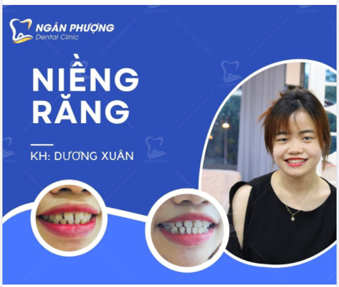 Kỳ tích là tên gọi khác của sự nỗ lực