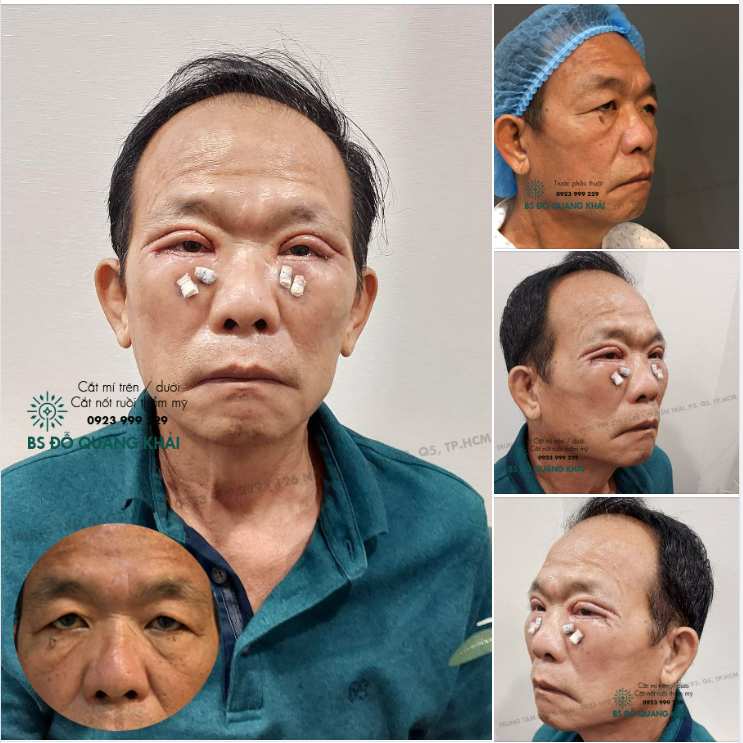 LÀM ĐẸP KHÔNG PHẢI ĐẶC QUYỀN CỦA NỮ GIỚI NAM GIỚI CŨNG CÓ THỂ THỰC HIỆN ANH KHÁCH HÀNG NGƯỜI ĐÀI LOAN