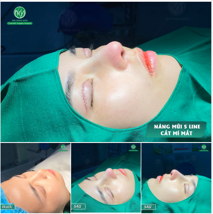 LÀM ĐẸP LÀ PHẢI LÀM CẢ COMBO