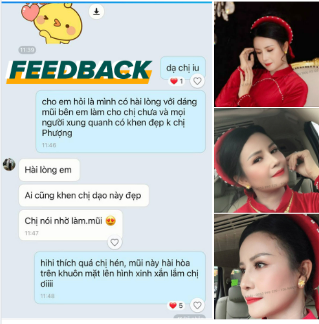 LÀM MŨI XONG THÌ TA LÊN XE BÔNG