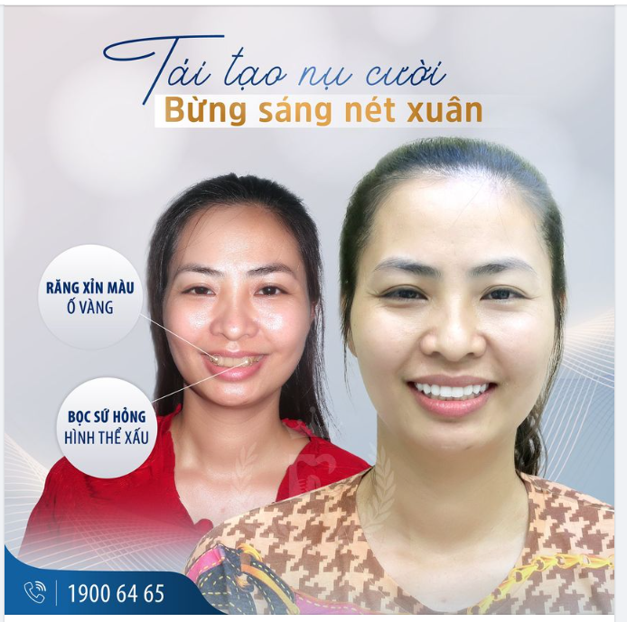 LÀM RĂNG SỨ HỎNG, PHẢI LÀM SAO?