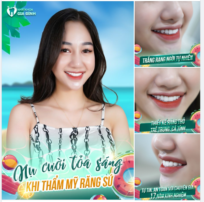 LÀM RĂNG THẨM MỸ AN TOÀN – KẾT QUẢ ĐẸP NHƯ Ý