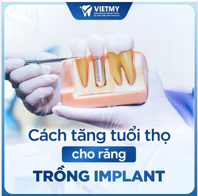 LÀM SAO ĐỂ TĂNG TUỔI THỌ CỦA RĂNG ĐƯỢC CẤY GHÉP IMPLANT?