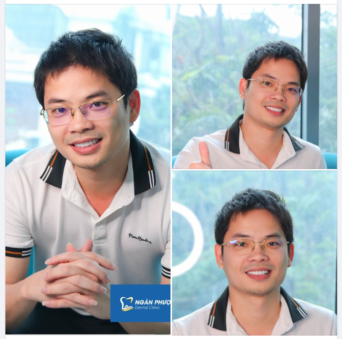 Lava Esthetic - Siêu phẩm hoàn mỹ trong công nghệ chế tác răng sứ