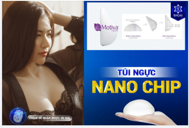 LOA ĐẸP LUNG LINH - TỰ TIN TỎA SÁNG